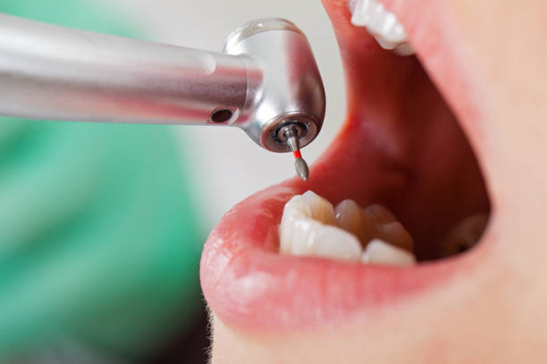 Best Walk-In Emergency Dental Services in Midway, UT